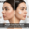 Pimple Care Face Wash