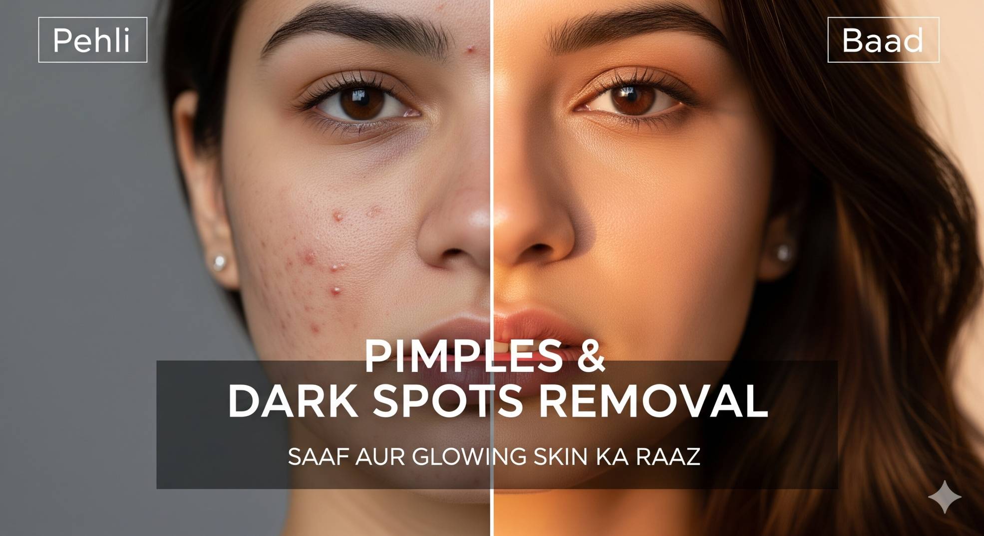 pimples and dark spots removal cream