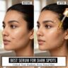 best serum for dark spots