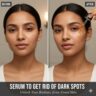 Serums to Get Rid of Dark Spots